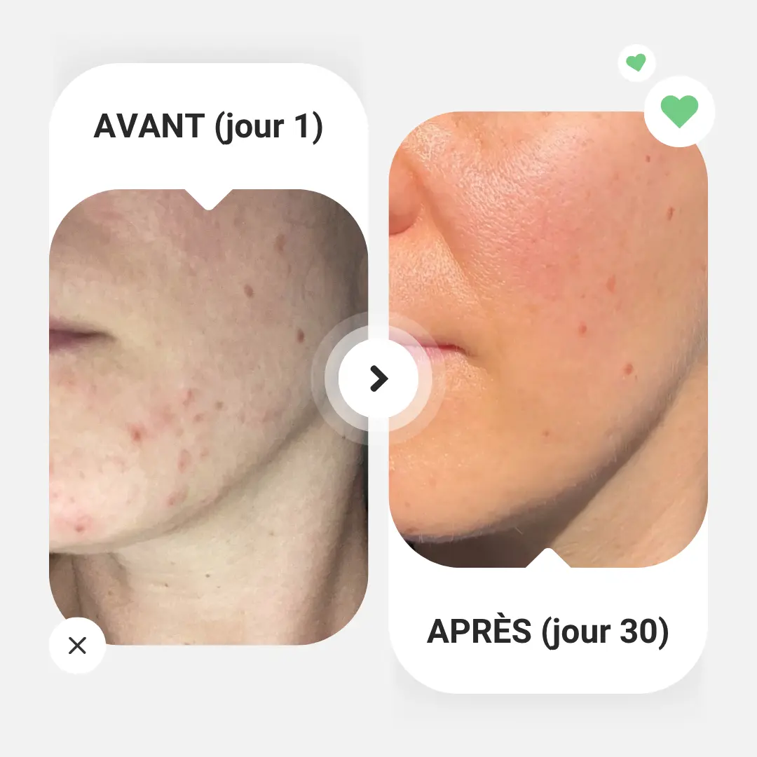 Coffret automne-hiver : SOS peau saine – Image 5