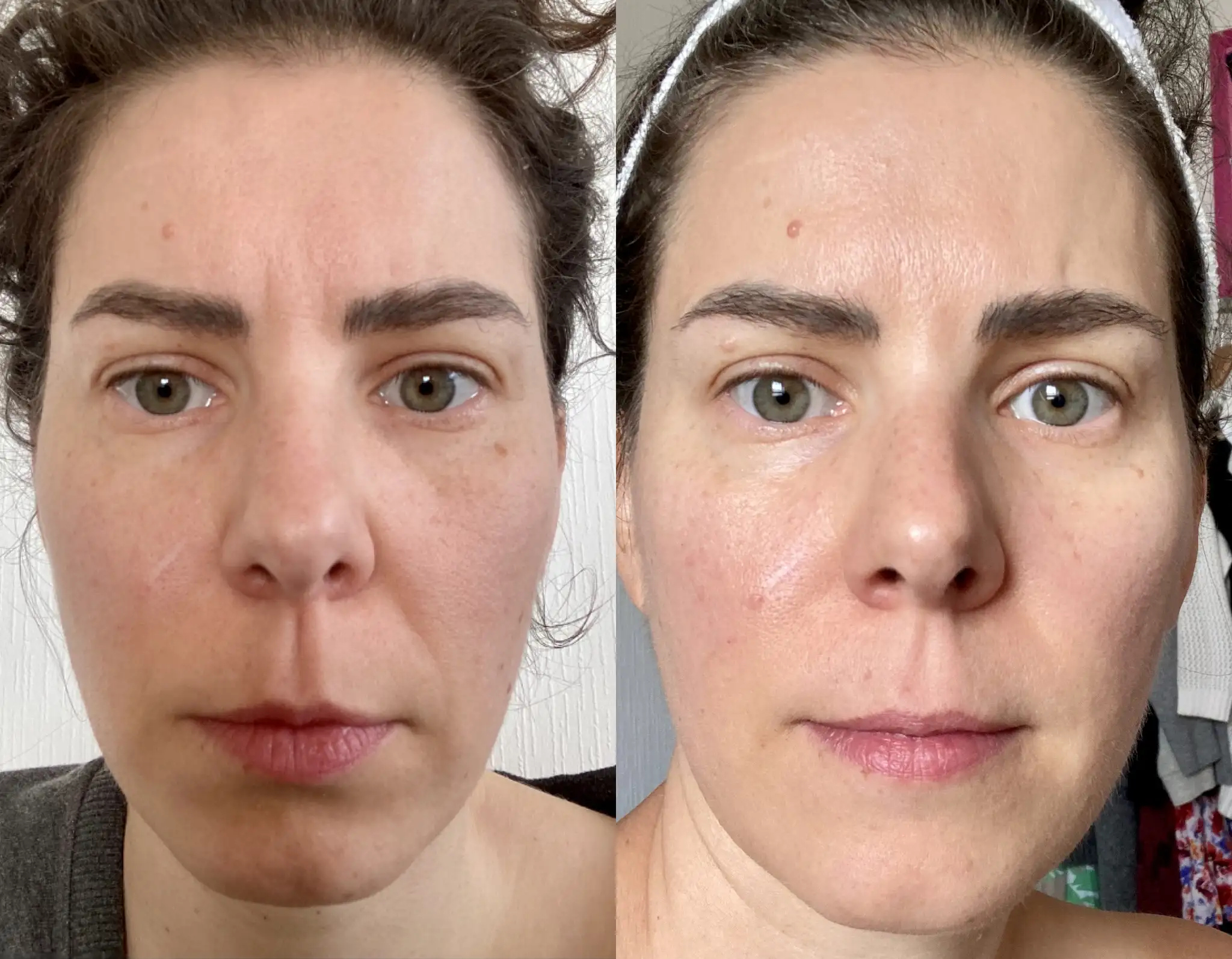 Formation automassage + yoga visage