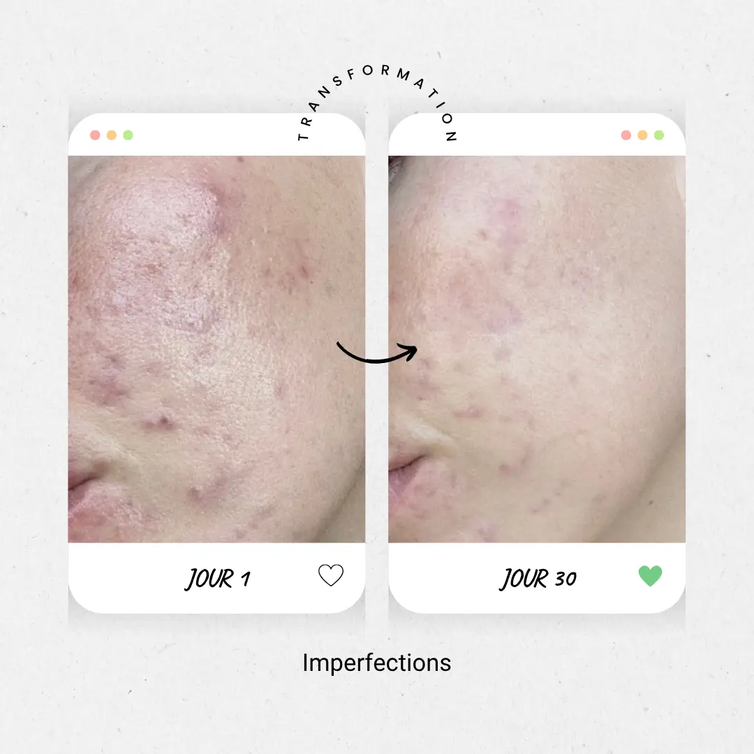 imperfections1