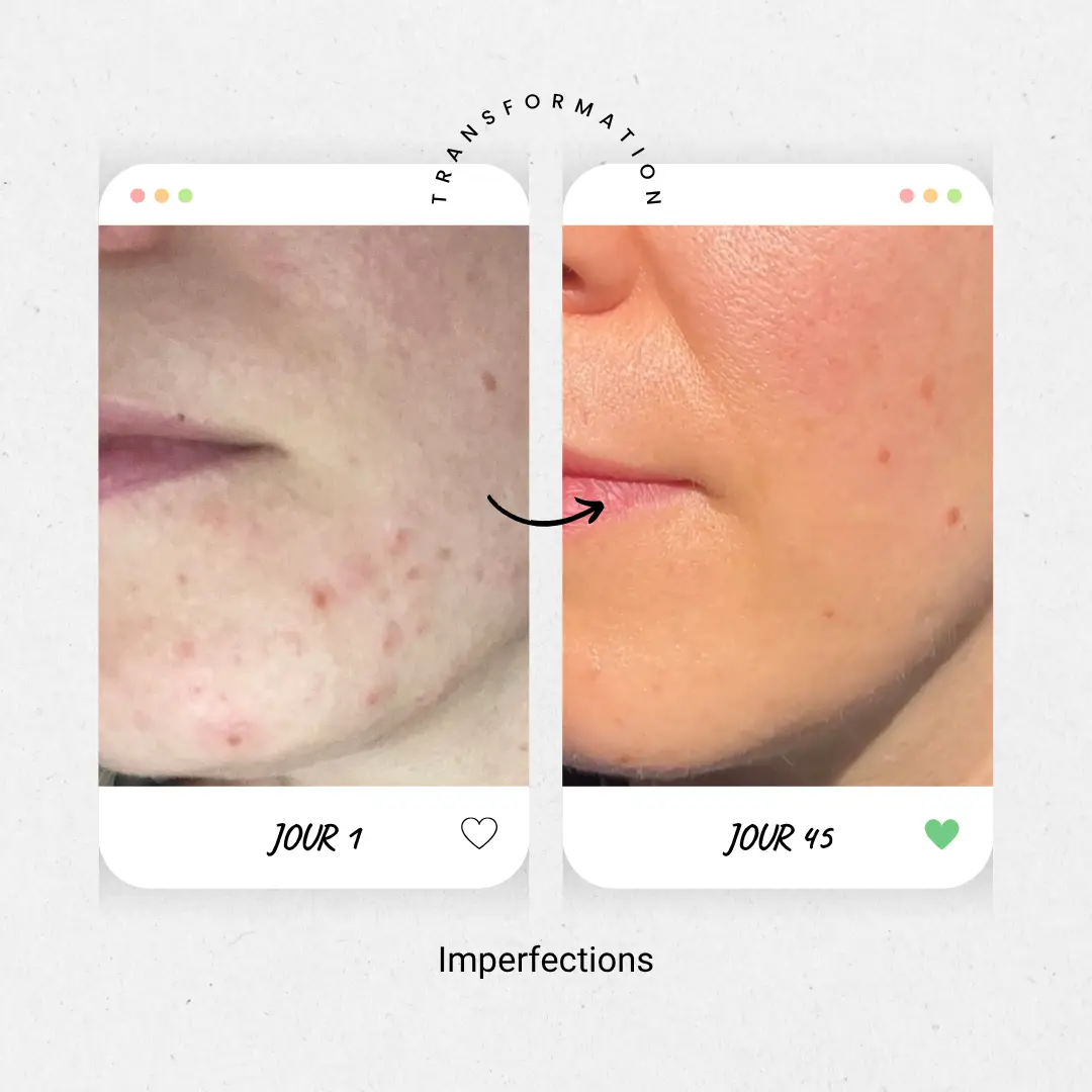 imperfections2