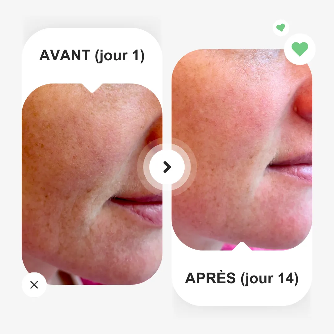 Concentré d'hydratation L'hydraboost – Image 3